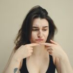 Hubungan Stres dan Jerawat: Kok Bisa?